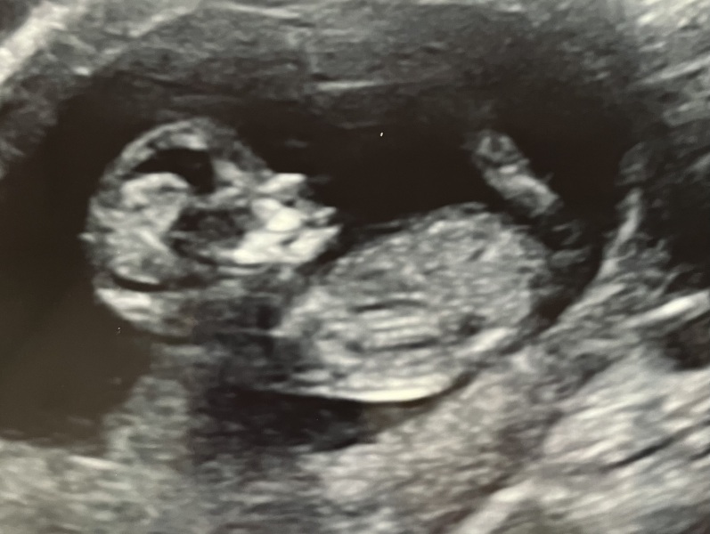 Due September - Thread 5! 🐣❤️🧡💛