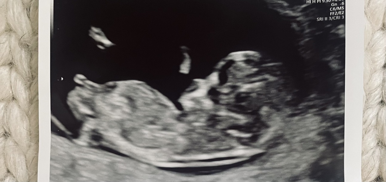 Boy or Girl - Nub Theory