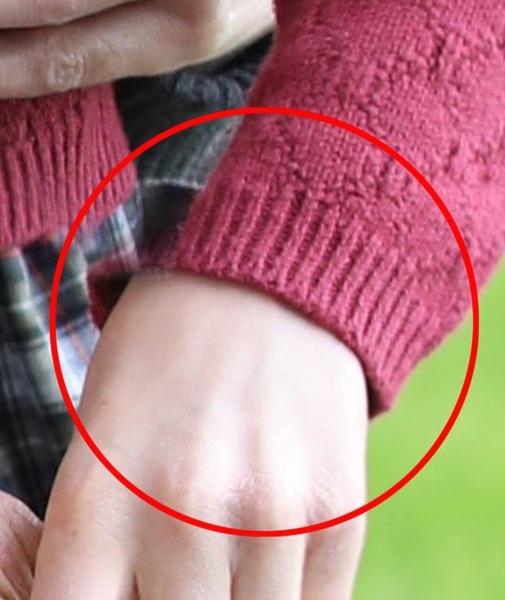 Kate's photo appears "manipulated"?