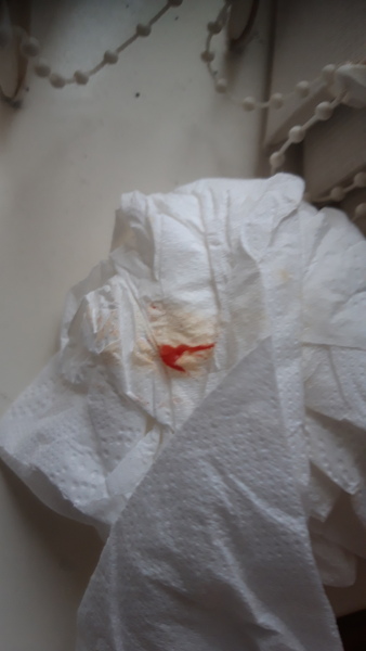 Blood - when pooed - pic