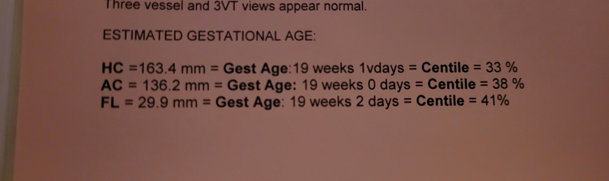 What size to buy newborn