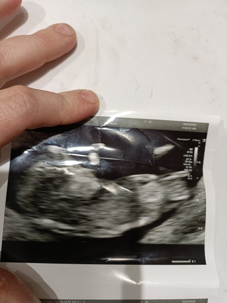 Boy or girl? Nub theory?