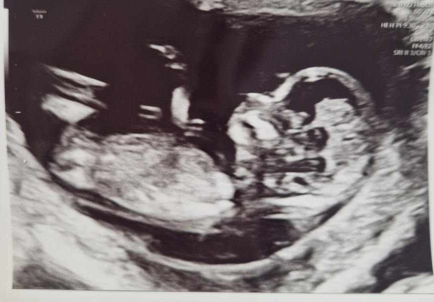 Due September 4.5 🐣♥️🧡💜