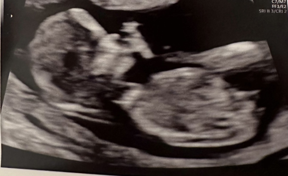 Boy or girl ? 