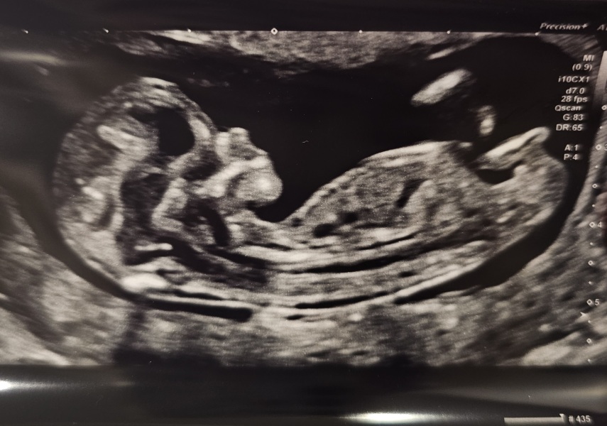 Due September - Thread 5! 🐣❤️🧡💛