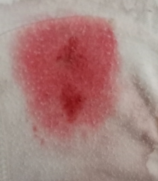 Have I miscarried? Photo. *trigger warning*