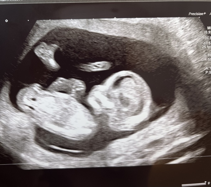 Due September - Thread 5! 🐣❤️🧡💛