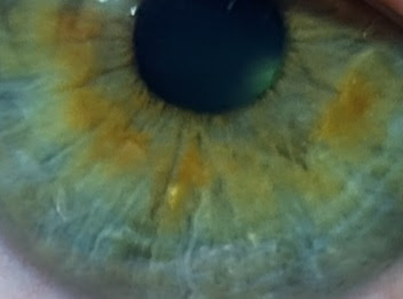 For all those 'what colour are my eyes' posts