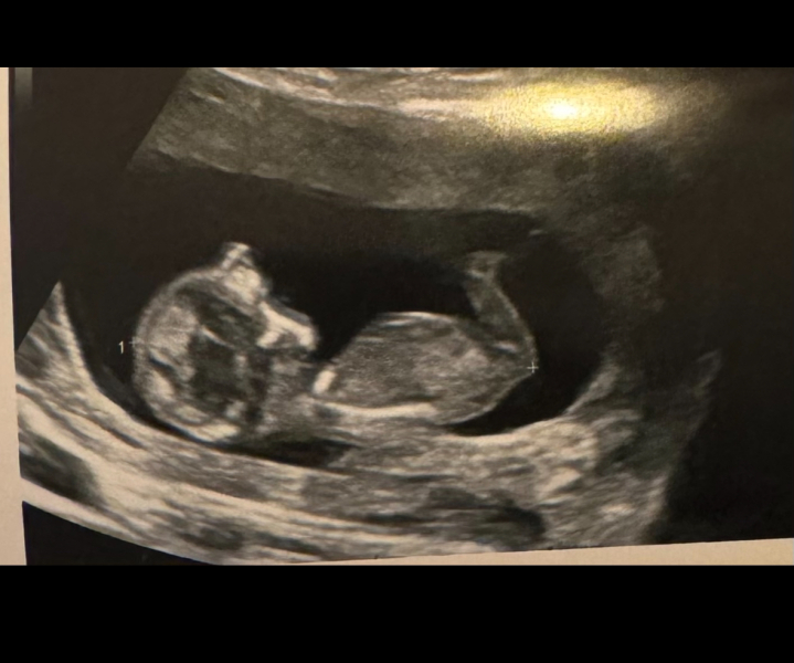 October 2024 Babies thread 2 👶