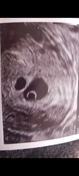 October 2024 Babies thread 2 👶