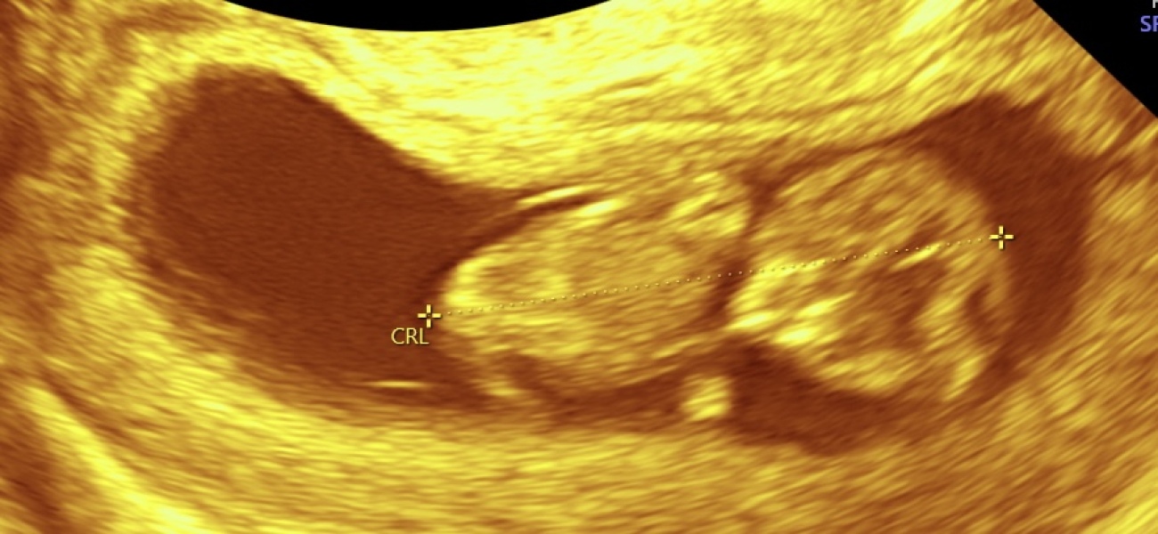 OCTOBER 2024 BABIES :) THREAD 3