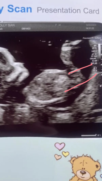 Due September - Thread 5! 🐣❤️🧡💛