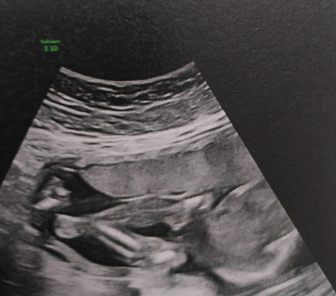 Excited to know girl or boy ..any guesses please 😇