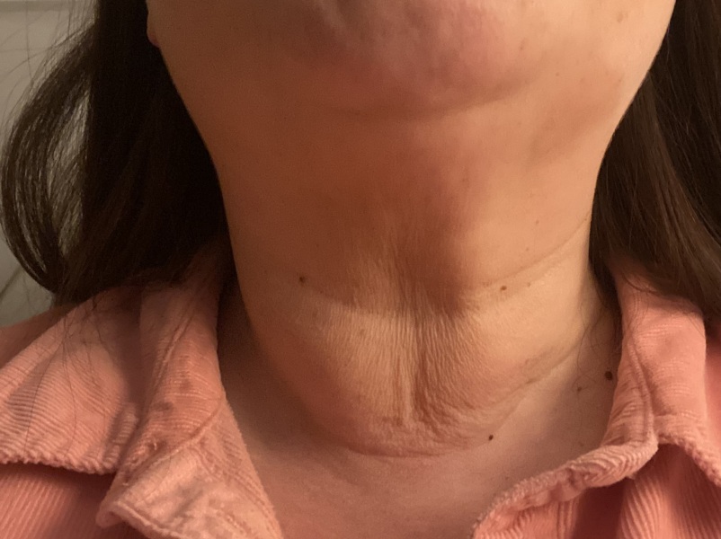 Help with this neck!!