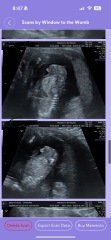 16 week scan, is it right?