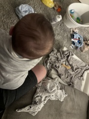 How severe is this plagiocephaly?