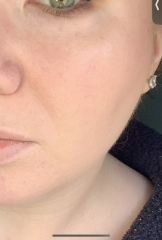 If your skin used to be bad but isn’t anymore, what worked?