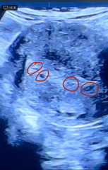 Baby due Nov 2024