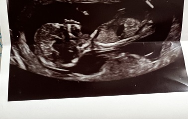 Any gender predictions??