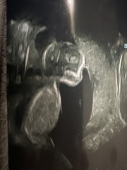 Scan picture inbetween the legs! Boy or girl?
