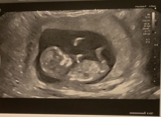 OCTOBER 2024 BABIES :) THREAD 3