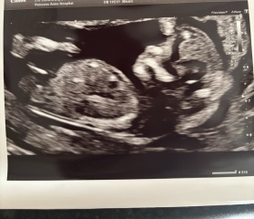 Has anyone had nub theory be wrong?