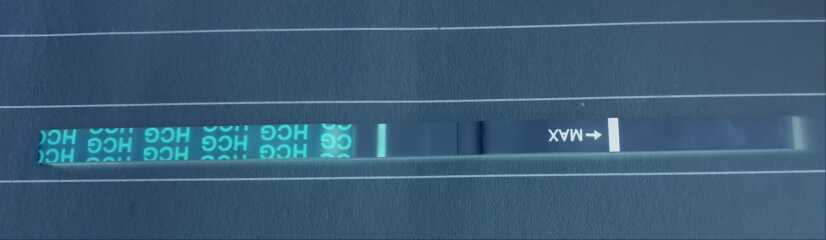 And so it begins again… 4dpo