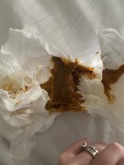Is this normal 6 week old baby poo