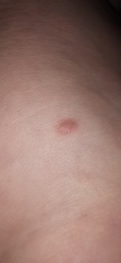 Is this worth getting checked?