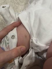 What is this mark on my child’s thigh??