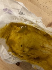 Warning - baby poo - normal?