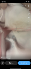 Implantation bleeding?