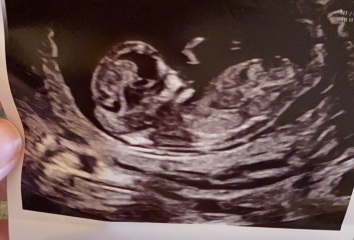Please help...12+3 days...boy or girl?