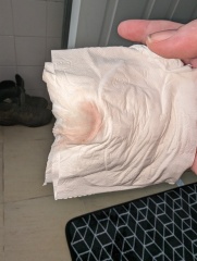 Twitching in uterus during TWW?????