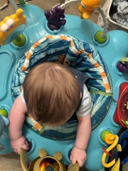 Is this severe flat head?