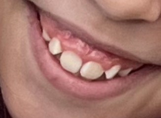 Any Dentists/ortho can advise?