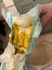 Warning - baby poo - normal?