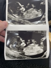 Boy or girl?