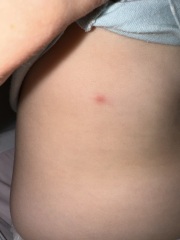 Toddler random spots