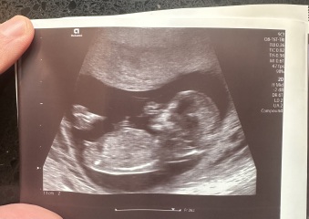Gender guesses just for fun? Nub theory