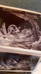 Please help if you can...boy or girl?