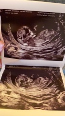 Please help if you can...boy or girl?