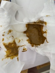 Is this normal 6 week old baby poo