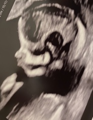 Boy or Girl?