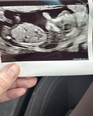 Has anyone had nub theory be wrong?