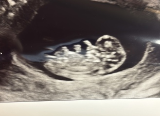 Boy or Girl?? Nub Theory