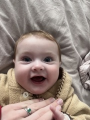 6 month old uneven cheeks.