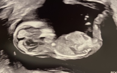 Boy or Girl?