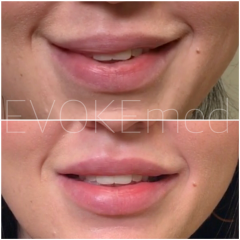 To find this kind of smile annoying?