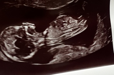 Any gender predictions??